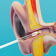 Hand demonstrating safe ear wax removal with a reusable ear cleaning tool.